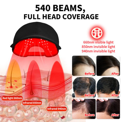 Cap: Wireless Red & Blue Light Therapy Cap for Scalp Health, Energy, and Self-Care | Red Light Therapy on the Go for Men & Women