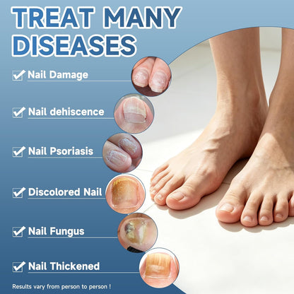 Maximum Strength Nail Fungi Treatment, Restore and Repair Damaged, Discolored Nails